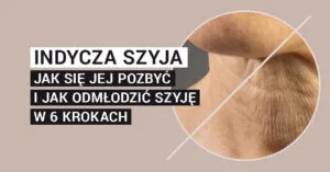 Indycza szyja — jak się jej pozbyć i jak odmłodzić szyję w 6 krokach